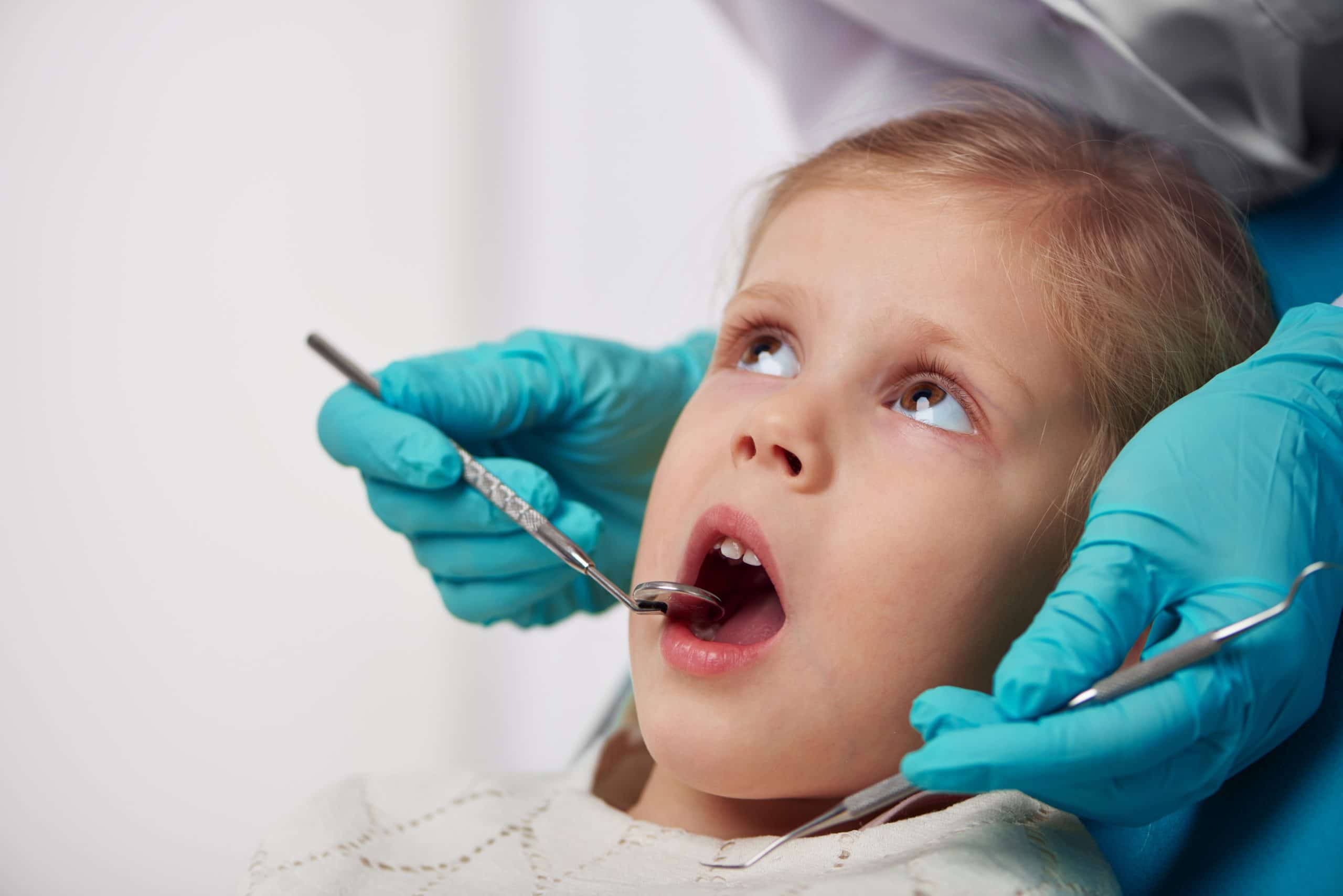 Bad Habits That Lead to Tooth Decay in Children